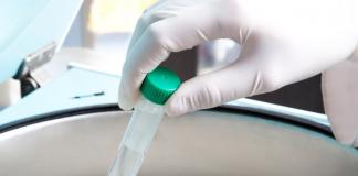 Основные симптомы и лечение вызванного кишечной палочкой цистита Кишечная палочка у женщин